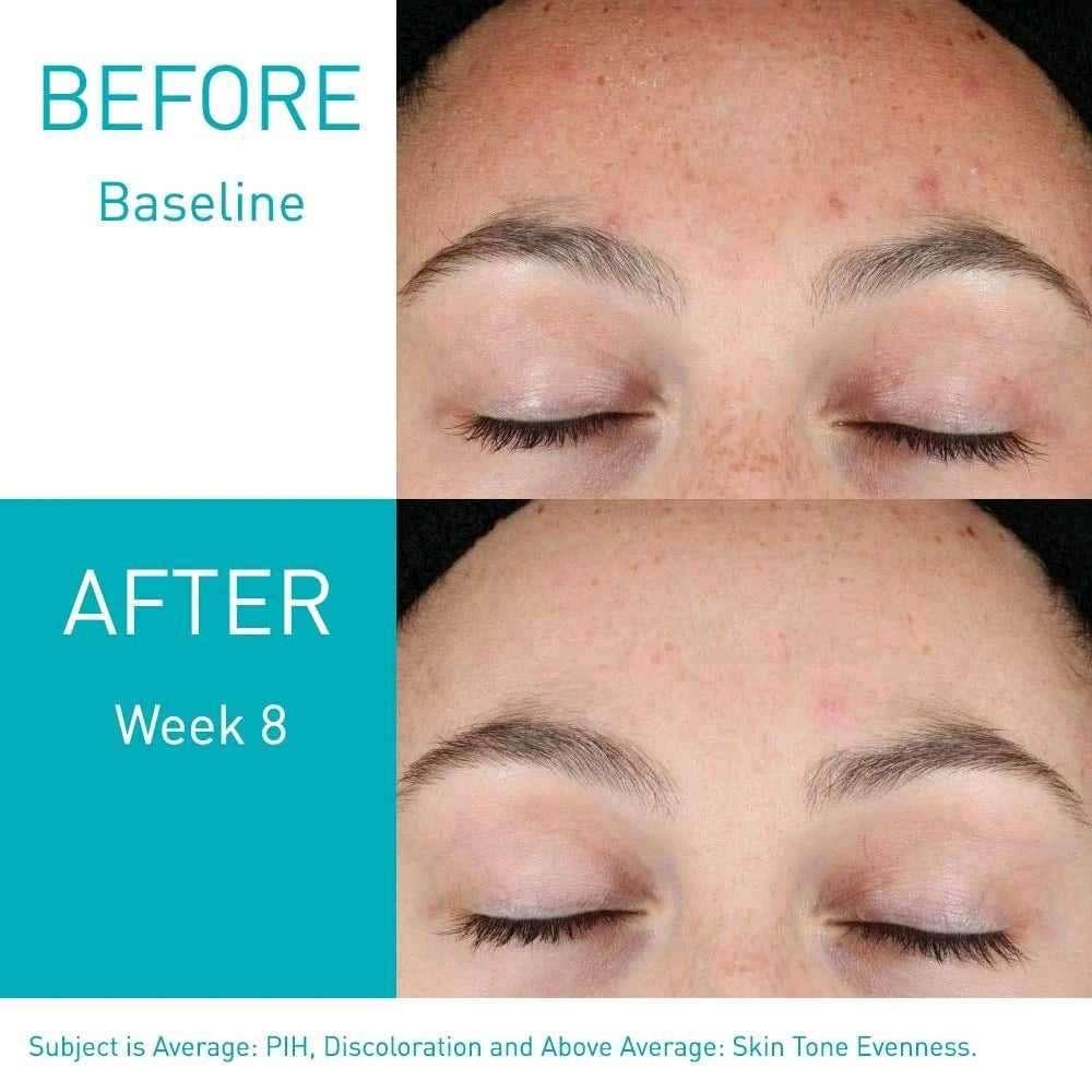 CeraVe Resurfacing Retinol Serum, Skin Renewing Retinol Serum & Hydrating Hyaluronic Serum - Image 3